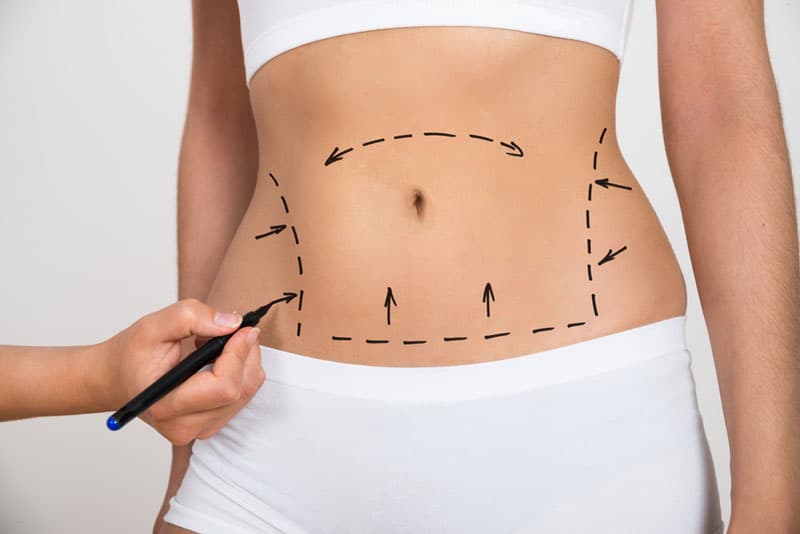Finish Off Your Weight Loss Journey With CoolSculpting